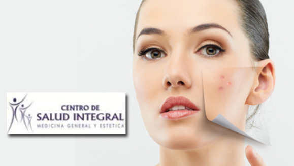 [Image: ¡Paga $30 en lugar de $140 por una Sesión de Microdermoabrasión más limpieza profunda + 2 Sesiones de Peeling +   3 Mascarillas Anti-envejecimiento o Anti-inflamatoria + 3 Altafrecuencias  + Evaluación con Lámpara Wood en Centro de Salud Integral!m]