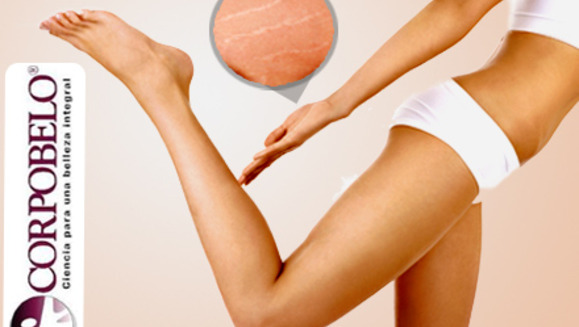 [Image: ¿Te incomodan las estrías? ¡Paga $40 en lugar de $285 por paquete para estrías que incluye: 3 Microdermoabrasiones + 3 Mesoterapias Virtuales en Corpobelo San Benito!m]