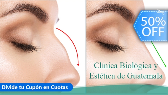 Clínica Biológica | ¡Rinomodelación sin Cirugía! Per... Clínica Biológica | ¡Rinomodelación sin Cirugía! Per...