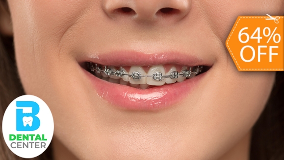 [Image: ¡Paga $40 en Lugar de $110 por Colocación de Brackets Metálicos + Evaluación y Diagnóstico Clínico + Rayos X + 1 Consulta de Control + 1 Limpieza Dental!m]