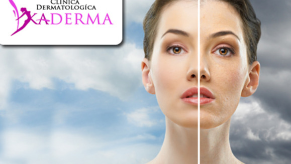 [Image: ¡Paga $35 en lugar de $125 por 2 sesiones de microdermoabrasión con punta de diamante + diagnostico médico de la piel en Clínica Dermatológica Kaderma!m]