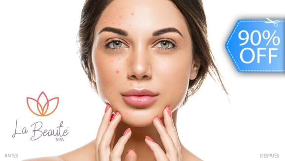 [Imagen:¡Paga Q99 en Lugar de Q950 por Facial Antiacné con Limpieza Profunda + Extracción + Peeling Ultrasónico + Láser Frío + Tónico Seboregulador + Terapia LED + Mascarilla Personalizada + Cauterización de Barros + Aplicación de Protector Solar!]