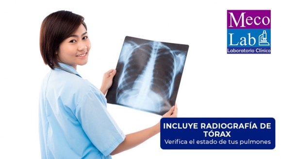 [Image: ¡Paga $18 en Lugar de $150 por Opción A: Prueba PCR (Proteína C Reactiva) + 19 Exámenes de Laboratorio u Opción B: Prueba PCR (Proteína C Reactiva) + Radiografía de Tórax!m]