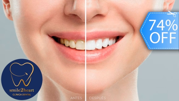 [Image: ¡Paga Q395 en Lugar de Q1,500 por Blanqueamiento con Luz LED + Pulido Dental + Plan de Tratamiento + Evaluación con Cámara Intraoral!m]