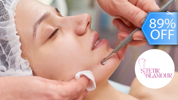 [Image: ¡Paga Q89 en vez de Q800 por 2 Sesiones de Limpieza Facial Profunda con Microderm Vacum + Radiofrecuencia + Extracción de Puntos Negros + Exfoliación + Mascarilla de Arcilla o Carbón Activado + Aplicación de Vitamina E y Bloqueador Solar!m]