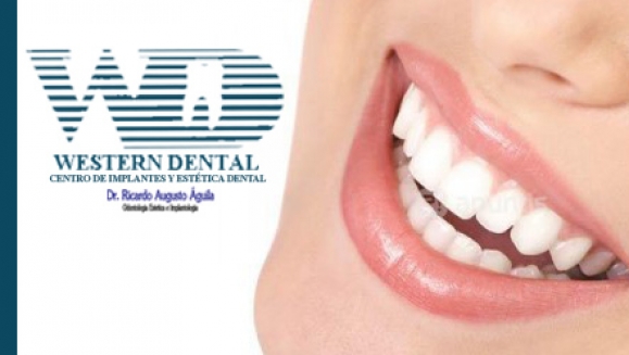 [Image: ¡Paga $30 en lugar de $150 por Consulta Odontológica + Diagnóstico Buco-Dental con cámara intraoral + Limpieza con Ultrasonido + 1 radiografía + 2 rellenos estéticos o 4 sellantes en Western Dental! Recibe 20% de descuento en servicios adicionales.m]