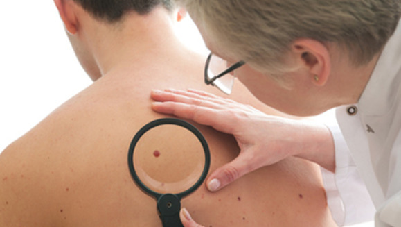 [Image: ¡Paga Q30 en lugar de Q100 por eliminación de Verrugas (Mezquinos) o lunares o cabezas de vena por medio de Electrofulguración en Clínica Biológica y Estética de Guatemala!m]