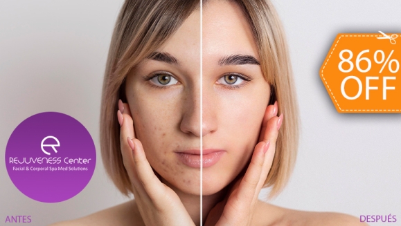 [Image: ¡Paga $30 en vez de $210 por 3 Sesiones Faciales para Tratar Manchas Solares, Acné o Líneas de Expresión con 3 Peelings de Ácido Glicólico- Láctico + 3 Mascarillas de Colágeno + Análisis Facial y Más!m]