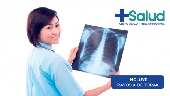 [Image: ¡Paga Q399 en lugar de Q577 por Exámenes Post-Covid19: Rayos X de Tórax + Hematología Completa + Orina y Heces Completa + Proteína C Reactiva + Consulta Médica Virtual para Lectura de Resultados!m]