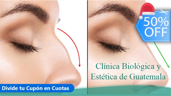[Image: ¡Paga Q999 en Lugar de Q2,000 por Rinomodelación con Ácido Hialurónico: Perfila, Modela y Respinga la Punta de La Nariz Sin Cirugía!m]