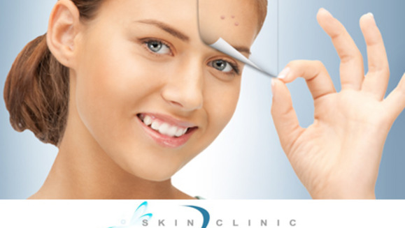 [Image: ¡Paga Q125 en lugar de Q775 por paquete facial que incluye: Microdermoabrasión con punta diamante o Peeling Químico + Limpieza Facial Profunda + Mascarilla de Hidratación en Skin Clinic!m]