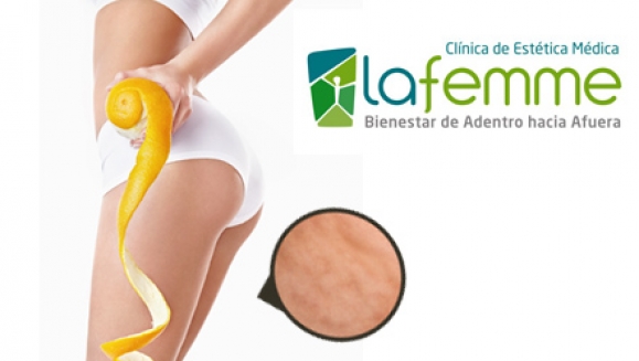 [Image: ¡Paga Q150 en lugar de Q1150 por Paquete Anticelulítico de 10 tratamientos que incluye: 3 Masajes Anticelulíticos + 3 Lipocavitaciones + 3 Endermologies + 1 Gel de Algas Reafirmante en La Femme! Recibe adicional 1 Sesión Nutricionalm]