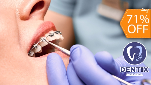 [Image: ¡Paga $40 en Lugar de $140 por Colocación de Brackets Metálicos + Evaluación y Diagnóstico Clínico + 1 Consulta de Control + 1 Limpieza Dental + 2 Rellenos Dentales!m]
