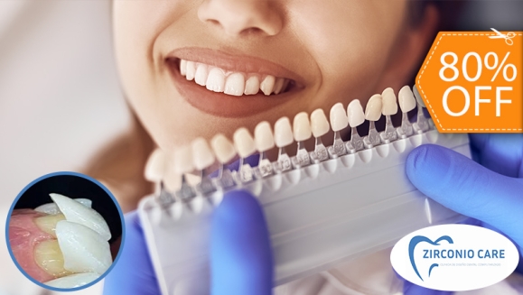 [Image: ¡Logra una sonrisa perfecta! Paga $25 en lugar de $125 por Diseño de Sonrisa con: Carilla Dental de Resina Nano Híbrida de Porcelana y Zirconio!m]