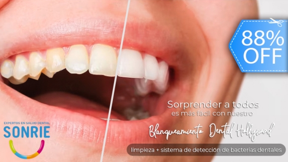 [Image: ¡Paga Q449 en Lugar de Q3,598 por Blanqueamiento Dental con Luz LED + Limpieza Ultrasónica Profunda con Eliminación de Sarro y de Manchas de Colorantes con Pulido Profiject + Sistema de Detección de Bacterias Dentales!m]