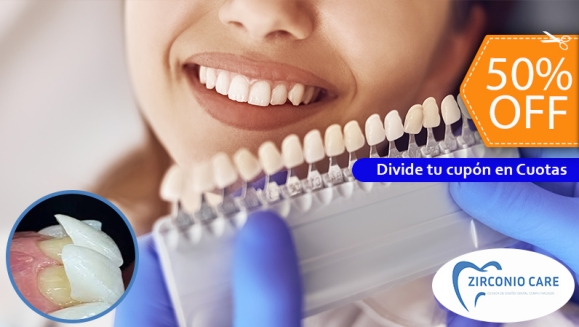 [Imagen:¡Paga $62.50 en Lugar de $125 por Carilla Dental de Cerómero + Limpieza Dental con Ultrasonido!]