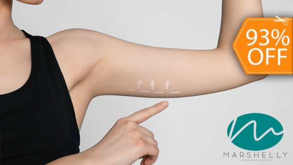 [Image: ¡Paga $34 en Lugar de $489 por 14 Tratamientos para Reducción de Brazos: 3 Criolipólisis + 3 Lipolaser + 2 Mesoterapias Virtuales o Inyectadas + 6 Lipogeles + Evaluación Estética y Medición de Grasa + Menú Detox!m]