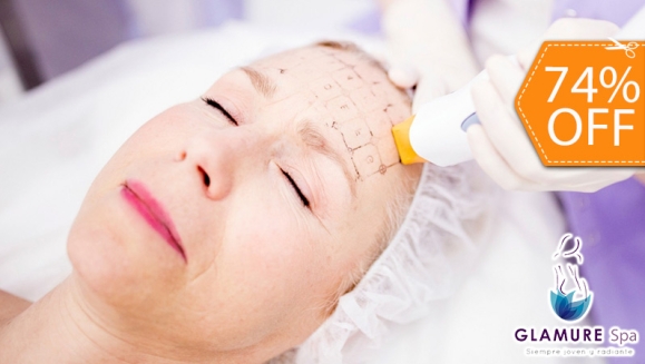 [Image: ¡Paga $25 en Lugar de $95 por Thermage Efecto de Lifting Facial + Limpieza Facial con Leche Limpiadora + Extracción de Puntos Negros + 1 Mascarilla Hidratante o de Colageno!m]