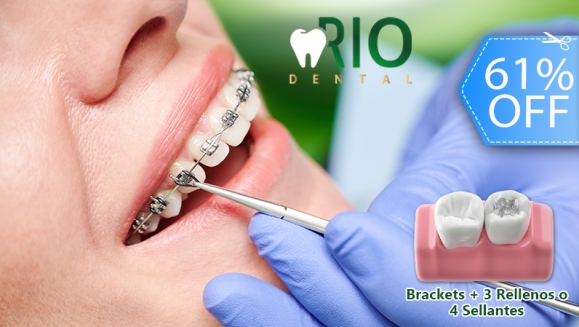 [Image: ¡Paga Q599 en Vez de Q1,550 por Colocación de Brackets Metálicos + 3 Rellenos o 4 Sellantes + Limpieza Profunda con Ultrasonido + Pulido Dental con Profijet + Evaluación Clínica + Fotografías Dentales + Aplicación de Flúor + Plan de Tratamiento!m]