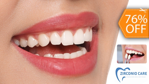 [Image: ¡Recupera Tu Sonrisa Perfecta! ¡Paga $30 en Vez de $125 por Paquete a Elección de Carillas Dentales de Resina Nano Híbrida de Porcelana y Zirconio Entre: A) 1 Carilla + Limpieza + Férula + Estuche, B) 2 Carillas + Limpieza o C) 4 Carillas!m]