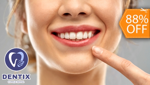 [Image: ¡Paga $25 en Lugar de $200 por Reconstrucción Mínimamente Invasiva de 4 Dientes Frontales + Consulta General + Revisión de Cordales + Limpieza dental + Aplicación Tópica de Flúor!m]