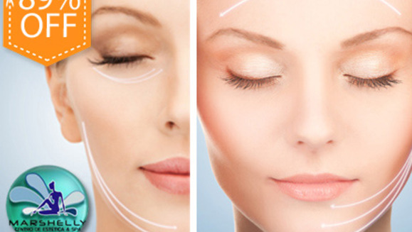 [Image: ¡Paga $49 en lugar de $450 por paquete facial Anti Edad que incluye: 1 Microdermoabrasión con Microcristales + Inyectaje de Ácido Hialurónico y Colágeno + Exfoliante + Luz Galvánica + Radiofrecuencia + 2 limpiezas profundas en Marshelly!m]