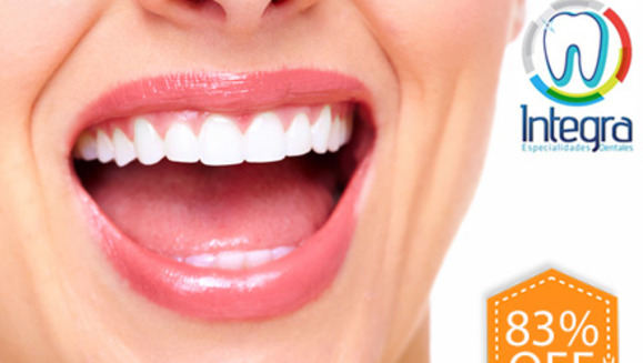 [Image: ¡Paga Q199 en lugar de Q1200 por Blanqueamiento Ambulatorio + Pulido y Desmanchado Dental + Eliminación de Sarro + Set de Fotografías Intraorales + Remineralización + Aplicación de Flúor + Evaluación Clínica en Integra Especialidades Dentales!m]