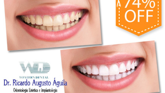 [Image: ¡Paga $85 en vez de $325 por 1 Sesión de Blanqueamiento Dental con Sistema Zoom + Consulta Odontológica + Diagnóstico con Cámara Intraoral + Limpieza con Ultrasonido en la lujosa sala VIP de Western Dental San Benito!m]