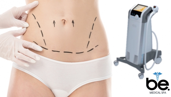 [Imagen:¡Paga Q1,999 en lugar de Q18,000 por Tratamiento Intensivo para Reducción de Medidas con Exilis Elite + 5 Lipólisis + Metabolización + Radiofrecuencia Trio X7 + Cavitación 40K + Mesoterapia PBS + Masaje Drenante + Masaje Reductor y Más!]