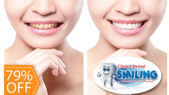[Image: ¡Paga $75 en lugar de $350 por Blanqueamiento Dental con Luz LED + Limpieza Dental con Ultrasonido + Aplicación de Desensibilizante + Aplicación de Flúor en Clínica Dental Smiling!m]