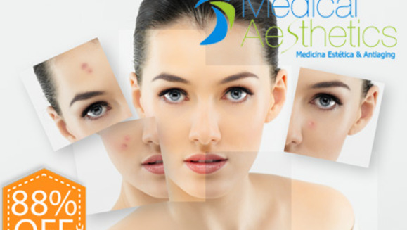 [Image: ¡Paga Q149 en lugar de Q1200 por Paquete Facial de Lujo que incluye: 1 Microdermoabrasión con Punta de Diamante + Peeling Enzimático + Exfoliación + Altafrecuencia + Mascarilla Relajante e Hidratante + Protector Solar en Medical Aesthetics!m]