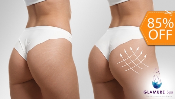 [Image: ¡Paga $24 en Lugar de $160 y Levanta, Moldea y Tonifica Tus Glúteos con 4 Rellenos + 4 Levantamientos + 4 Redondeos + 2 Tonificadores + 4 Alisamientos de Piel + 4 Moldeos de Espalda + 4 Moldeos de Cintura + 1 Cinturón Térmico!m]