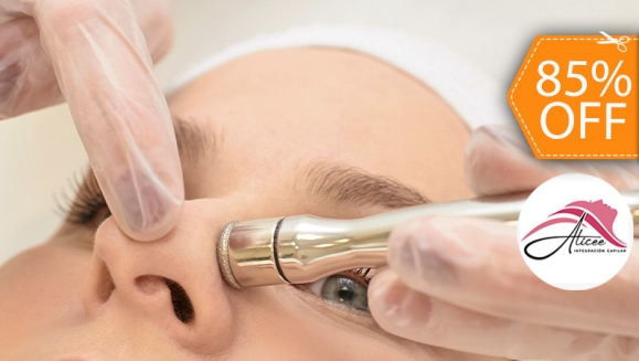 [Image: Borrar¡Paga $20 en Lugar de $130 por 2 Sesiones de Limpieza Facial Profunda con: 2 Microdermoabrasiones con Punta de Diamante + 2 Alta Frecuencias + 2 Limpiezas Faciales con Extracción de Puntos Negros + 2 Sesiones de Vapor de Ozono y Más!m]