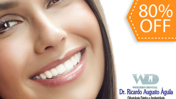 [Image: ¡Paga $30 en lugar de $150 por 2 Rellenos Estéticos de Resina Blanca o 4 Sellantes de Fosas y Fisuras + Diagnóstico Buco-Dental + Limpieza con Ultrasonido + Aplicación de Flúor en la Lujosa Sala VIP de Western Dental San Benito!m]