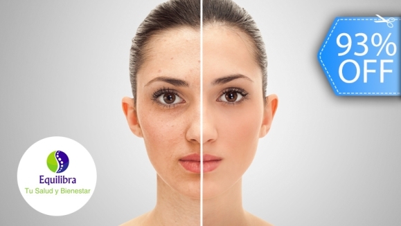 [Image: ¡Paga Q199 en Lugar de Q2,800 por Rejuvenecimiento y Relleno Facial para Eliminar Arrugas, Líneas de Expresión y Cicatrices que Incluye: Rellenos con Células Madre, Aplicación de Enzimas Plaquetarias, Estiramiento, Tensado Facial y Más!m]