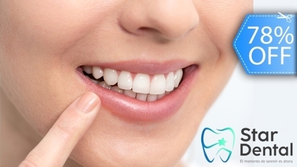 [Image: ¡Paga Q395 en Lugar de Q1,800 por Blanqueamiento Dental Químico con Luz LED + Remoción de Manchas con Profilaxis + Limpieza con Ultrasonido +  Evaluación Completa con Plan de Tratamiento incluido!m]