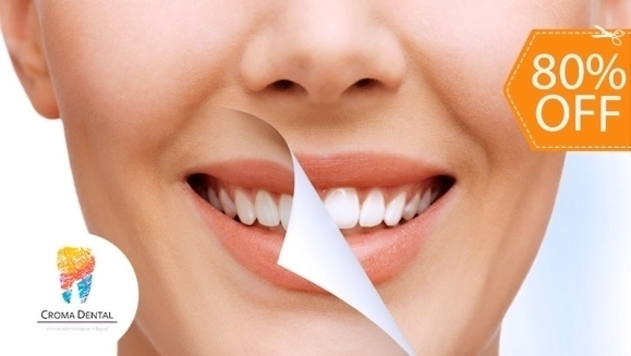[Image: ¡Paga $50 en Lugar de $255 por Blanqueamiento Dental Químico con Luz LED + Limpieza Profunda con Ultrasonido (Detartraje) + Consulta Odontológica!m]