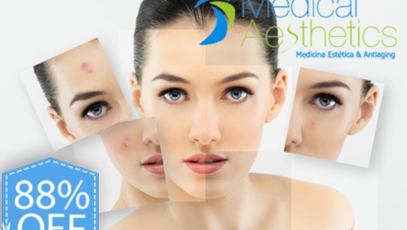 [Image: ¡Paga Q199 en lugar de Q1600 por Paquete Facial PRE VERANO que incluye: 2 Microdermoabrasiones  + 2 Peeling Iluminadores de Vitimina C + 2 Exfoliaciones de Vitamina C y Toronja y más en Medical Aesthetics!m]