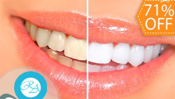 [Image: ¡Paga $35 en lugar de $120 por Blanqueamiento Dental de 2 Cubetas + Limpieza con Ultrasonido + Pulido con Bicarbonato + Diagnóstico con Cámara Intraoral en Clínicas Médicas Romano!m]