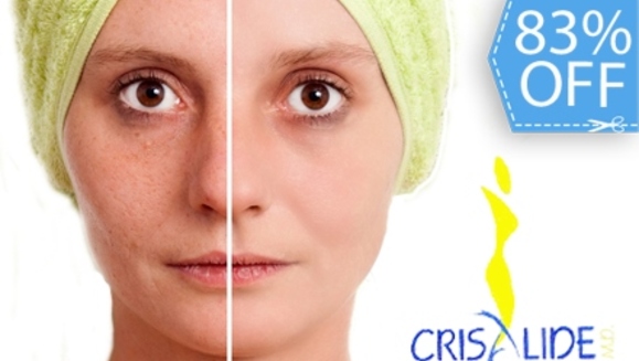 [Image: ¡Paga Q135 en lugar de Q800 por Paquete Facial Post Verano que incluye: Peeling con Ácido Lactobiótico + Microdermoabrasión con Punta de Diamante + 2 Altas Frecuencias + 2 Mascarillas Antiacné o Antiaging + 2 Hidrataciones en Crisalide!m]