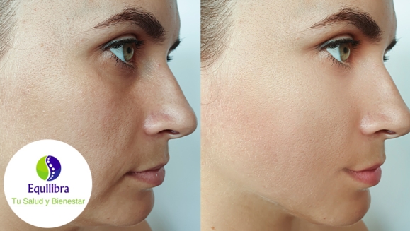 [Image: ¡Paga Q1,299 en Lugar de Q20,000 por Armonización Facial con Tratamiento Personalizado que Incluye: Bioestimulación + Aplicación de Ácido Hialurónico + Rellenos Faciales + Aparatología Médica + Aplicación de Botox + Evaluación!m]