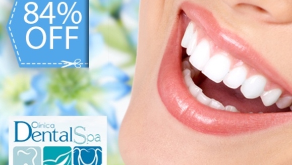 [Image: ¡Paga Q395 en lugar de Q2,400 por Blaqueamiento Láser + Pulido  Dental con Profijet + Limpieza Profunda con Ultrasonido + Aplicación de Flúor + Examen Completo y Evaluación con Cámara Intraoral en Dental Spa!m]