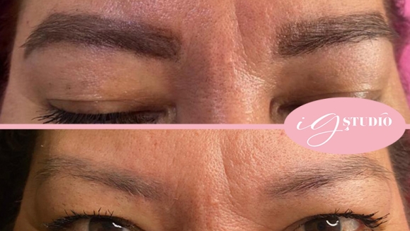 [Image: ¡Paga $50 en Lugar de $100 por 2 Sesiones Láser para Remover o Aclarar Micropigmentación de Cejas!m]