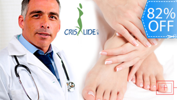 [Image: ¡Deshazte de los Hongos en la Uñas de una Sola Vez!¡Paga Q185 en lugar de Q1,050 por Tratamiento Láser para Hongos en las Uñas + Examen Diagnóstico por Médico Especializado en Crisalide!m]