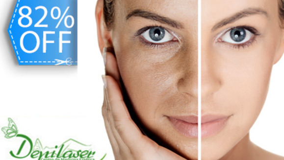 [Image: ¡Paga Q245 en vez de Q1,395 por Paquete de Limpieza y Foto-Rejuvenecimiento Facial con Tecnología E-Light de 14 Tratamientos con: Sesiones de E-light, Mascarillas y Exfoliaciones Orgánicas, Aplicaciones de Colágeno, Vitamina C y Más en Depilaser!m]