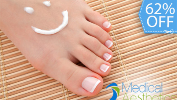 [Image: ¡Paga Q95 en lugar de Q250 por Pedicure Clínico que incluye: Exfoliación, Limado y Recorte de Uñas, Eliminación de Callosidades, Aplicación de Crema con Suero de Hidratación, Masaje Descongestivo y Esmaltado Gelish en Medical Aesthetics!m]