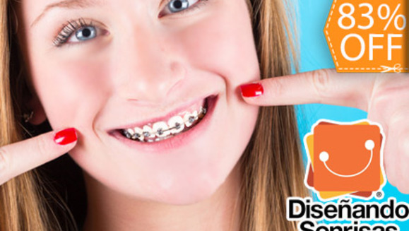 [Image: ¿Quién más quiere dientes perfectamente alineados? ¡Paga $95 en lugar de $550 por Colocación de Mini-Brackets Metálicos en Diseñando Sonrisas!m]