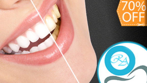 [Image: ¡Paga $70 en lugar de $237 por Blanqueamiento Dental con Sistema Zoom + Limpieza con Ultrasonido + Diagnóstico con Cámara Intraoral + Revisión de Cordales + Aplicación de Flúor para 1 Acompañante en Clínica Médica Romano y Asociados!m]