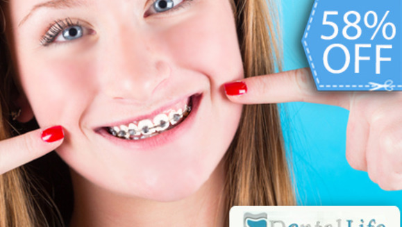 [Image: ¡Paga Q750 en lugar de Q1,800 por Colocación de Brackets Metálicos (Superiores e Inferiores) + Evaluación y Diagnóstico Clínico + Limpieza Completa y Más en Dental Life!m]