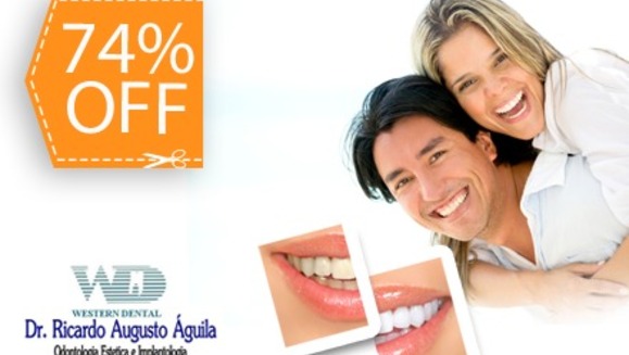 [Image: ¡Paga $85 en vez de $325 por 1 Sesión de Blanqueamiento Dental EXTREMO con sistema ZOOM + Limpieza con Ultrasonido en la Lujosa Sala VIP de Western Dental San Benito!m]